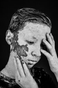 家庭用脱毛器で色素沈着を防ぐための生活習慣は？